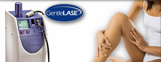 Laser 3