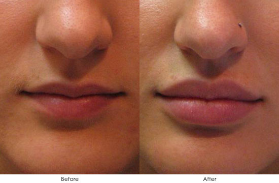 Lips-5