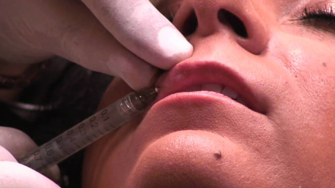 maxresdefault